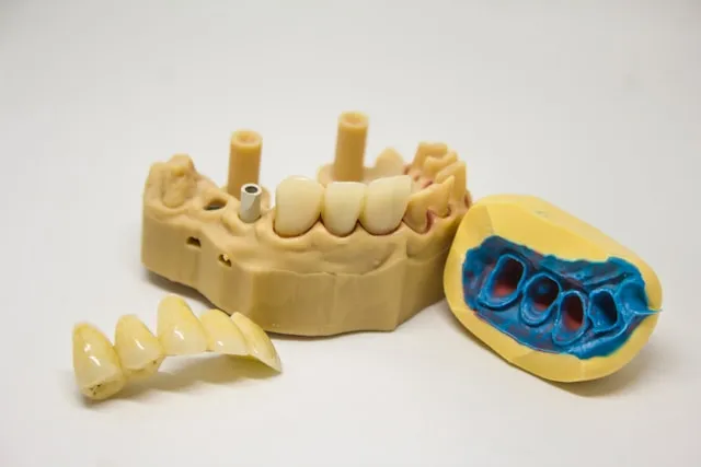 Prawidłowy rozwój szczęki i żuchwy: rola ortodonty